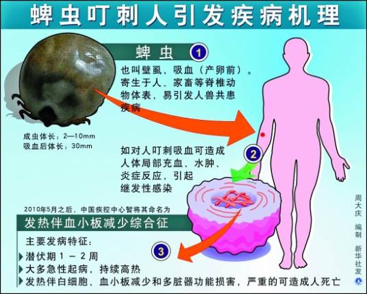 人粒细胞无形体病