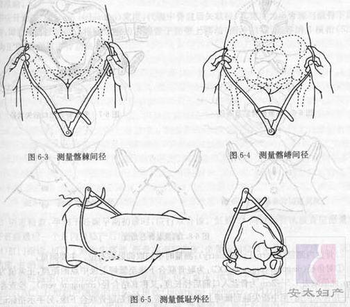 骨盆外测量