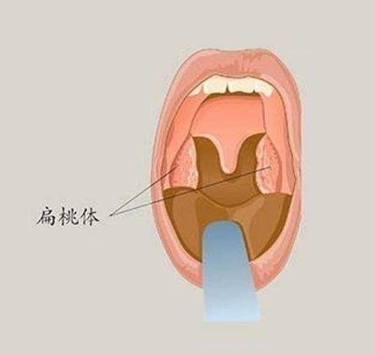 扁桃体（人体器官）